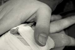 What is workers compensation benefits